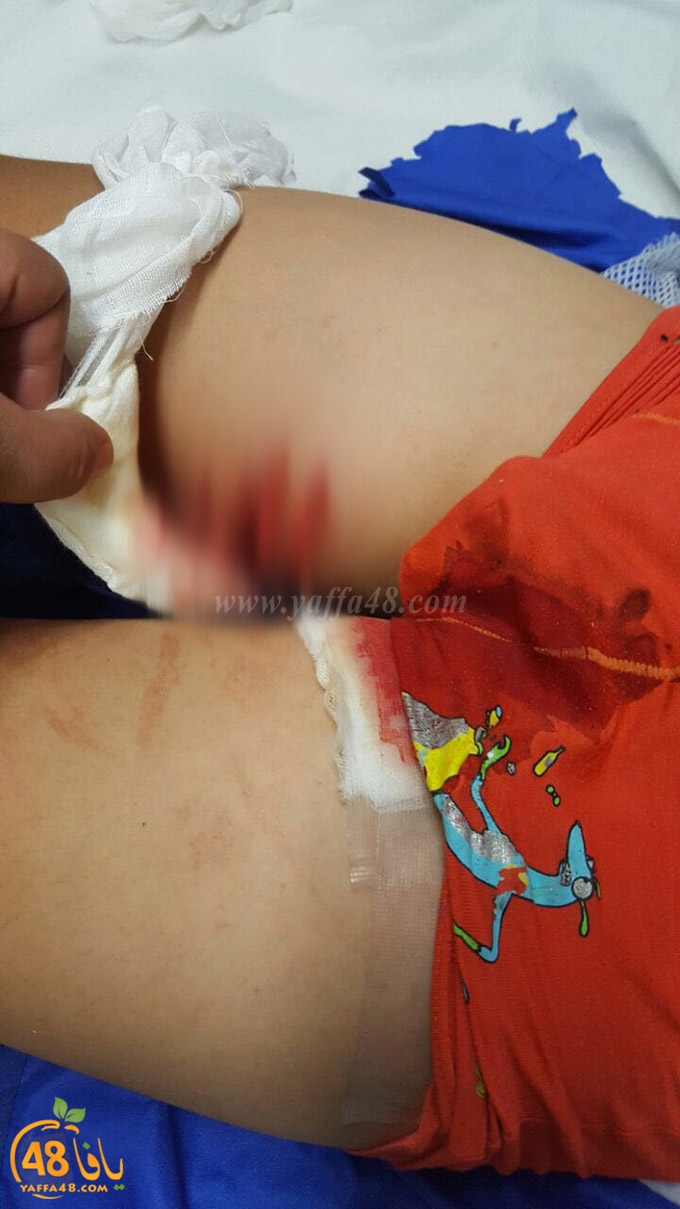 kid dog attack (3).jpg